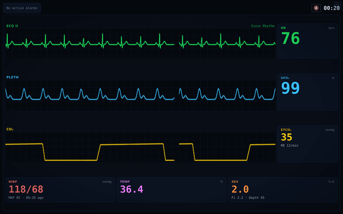 Full-screen student monitor with ECG, plethysmograph, and capnography waveforms and vital tiles